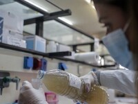 Λιγότερο κατά πολύ το ιικό φορτίο στα λύ...