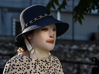 Επίθεση με βιτριόλι: Έπεφταν κομμάτια απ...