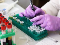 Ένα αντίσωμα συνδέει τις θρομβώσεις του ...