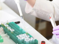 Μαγιορκίνης - Ευλογιά των πιθήκων: Σε αυ...