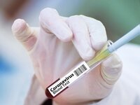 Εμβόλιο: Λιγότερες δόσεις από την Pfizer...