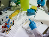 Κορωνοϊός: 385 κρούσματα στην Αχαΐα- Η κ...