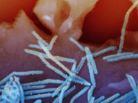 «Καμπανάκι» ECDC για τριπλή «αναζωπύρωση...