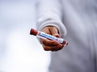 Κορωνοϊός: 151 νέα κρούσματα σήμερα – Τα...