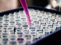 Ευλογιά των πιθήκων: Η Ολλανδία ανακοίνω...