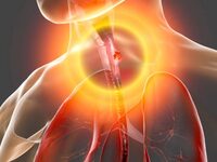 Όλα όσα πρέπει να ξέρετε για τον καρκίνο...