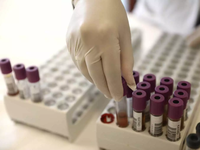 Απεργία στα διαγνωστικά κέντρα μέχρι το Σάββατο