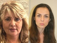 Πάτρα: Πόλεμος γιατρών για το "αίνι...