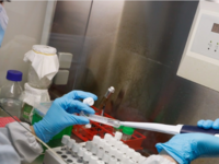 Ευλογιά των πιθήκων: Ο ΠΟΥ ζητά εντατικο...