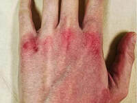 Συγκλονιστική η ανάρτηση με το κατακόκκι...