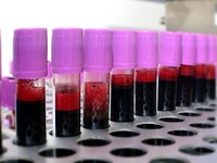 Η μετανάστευση μας «κόβει» το αίμα – Εθε...