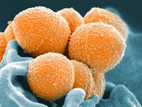 Στρεπτόκοκκος Α: Συναγερμός σε σχολεία -...