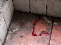 Δολοφονία 19χρονου: Τον σκότωσαν με δρεπ...