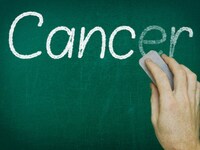 Η ιστορία του καρκίνου- Ξεκινάει χιλιάδε...