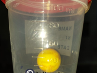 Δυτική Ελλάδα: Ένα μπαλάκι έκοψε την ανά...