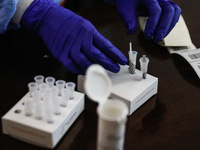 Στα 47 ευρώ η τιμή του μοριακού τεστ α...