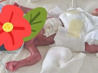 Πάτρα: Πρόωρο 23 εβδομάδων βγήκε νικητής...