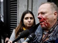 Χτύπησαν στο Σύνταγμα Γερμανό που κάλυπτ...