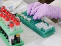 “Καμπανάκι” για τη γρίπη των πτηνών