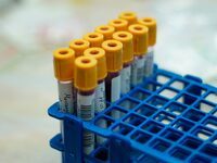 Η ομάδα αίματος που σχετίζεται με αυξημέ...