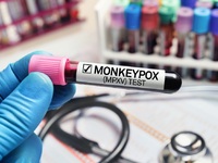 Ευλογιά των πιθήκων: Δεύτερος νεκρός στην Ισπανία