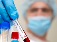 Ευλογιά των πιθήκων: Πρώτο κρούσμα της π...