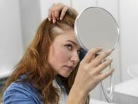 Τριχόπτωση: Οι 4 ελλείψεις σε θρεπτικά σ...