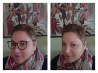 Πάτρα: Η Γαβριέλλα Πούπα, η μάχη με το λ...