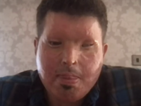 Συγκλονίζει ο Ανδρέας Χριστοφέρος, θύμα ...