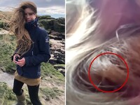 Για 84 ημέρες έκανε τα μαλλιά της φωλιά ...