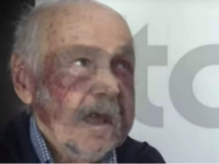 Χαλκίδα: Σακάτεψαν 90χρονο σε άγρια ληστ...