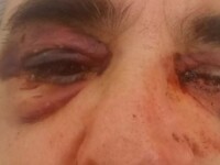 Telegraph για Μύκονο: Φωτογραφία ντοκουμ...