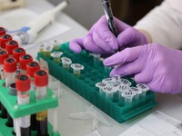 Στρεπτόκοκκος: Απειλή, λέει ο πρόεδρος Π...