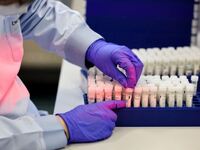 Κορωνοϊός: Τι μπορεί να συμβαίνει όταν τ...