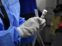 ΕΟΦ: Ανακαλεί rapid test για τον κορωνοϊό