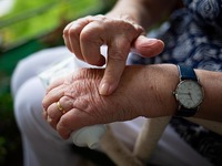 Ρευματοειδής αρθρίτιδα: Τα αδιόρατα σημά...