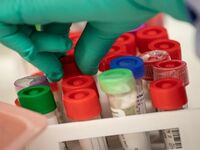 Ελληνίδα λοιμωξιολόγος του Cambridge: Σύ...