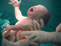 Πάτρα: Γέννησε με καισαρική σε νοσοκομεί...