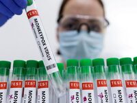 Έρευνα: Η ευλογιά των πιθήκων μεταδίδετα...