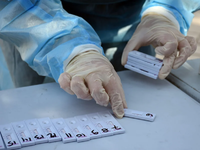 Έρχεται νέο φθηνό τεστ, σαν μοριακό, που...