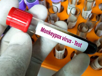 Ευλογιά των πιθήκων: Σύσταση για καραντί...