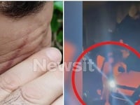 Αχαρνών: «Αν με χτυπούσαν με κάποιο αντι...