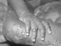 Εκπρόσωπος Τύπου ΠΟΥ: Έρχονται διαγνωστι...