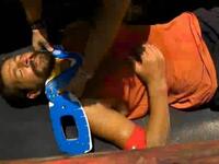 Survivor: Σοκαριστικός τραυματισμός για ...