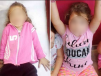 Μπουζιάνης για τις κακώσεις στο πρόσωπο ...