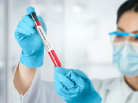 Βρέθηκε μέθοδος πρόβλεψης του κινδύνου α...