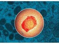 Νέο κρούσμα της ευλογιάς των πιθήκων στη χώρα μας