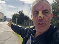 Δείτε πως κατέληξε γνωστός πατρινός που ...