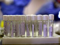 Κορωνοϊός: Αυτά είναι τα νέα συμπτώματα ...