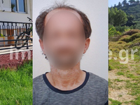 Ζάκυνθος: Στράβωσε το μαχαίρι από τα χτυ...